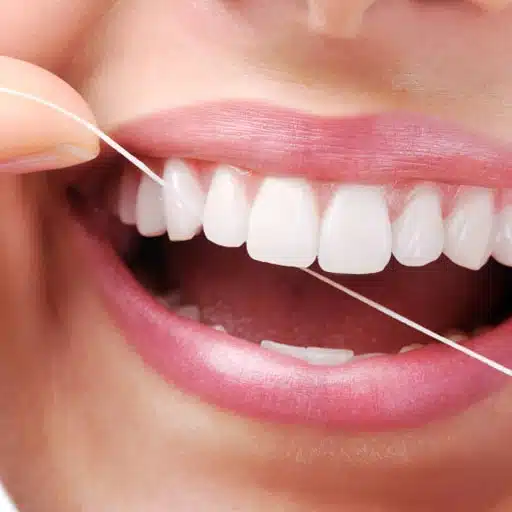 tratamento de periodontia